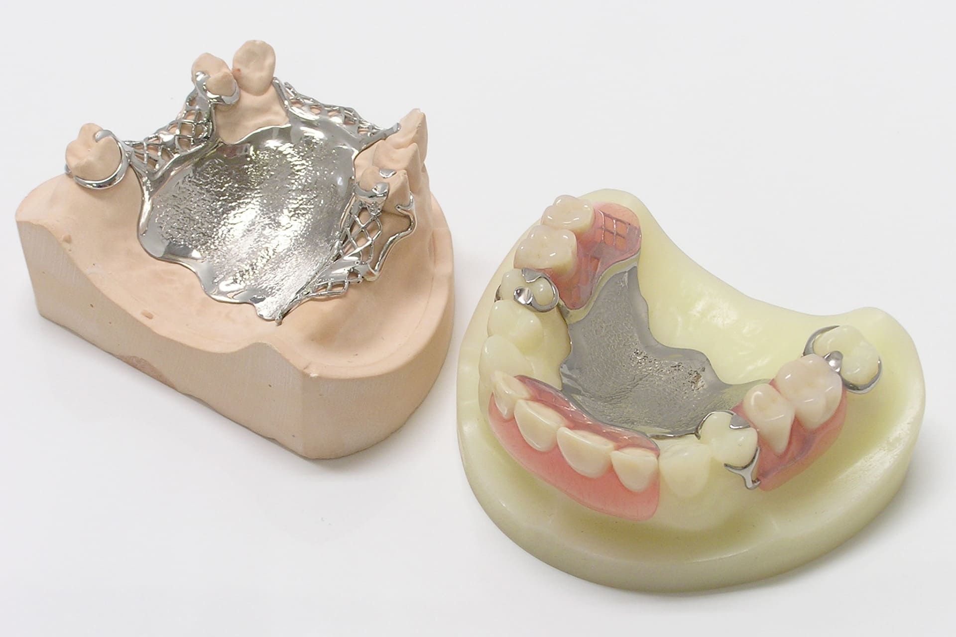 補綴治療（自由診療）